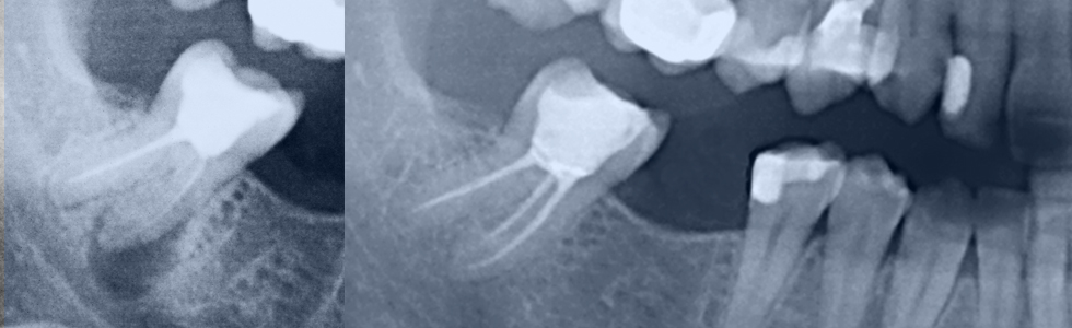 endodontie_praxis_schulwitz